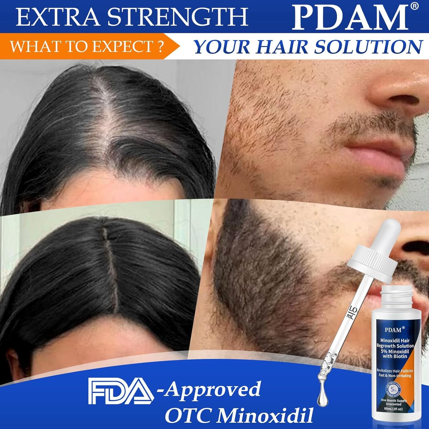 Minoxidil Hair Growth Serum for Men and Women - Regrow Fuller, Thicker Hair - 5% Formula Improves Appearance of Thinning Hair - 2 fl oz